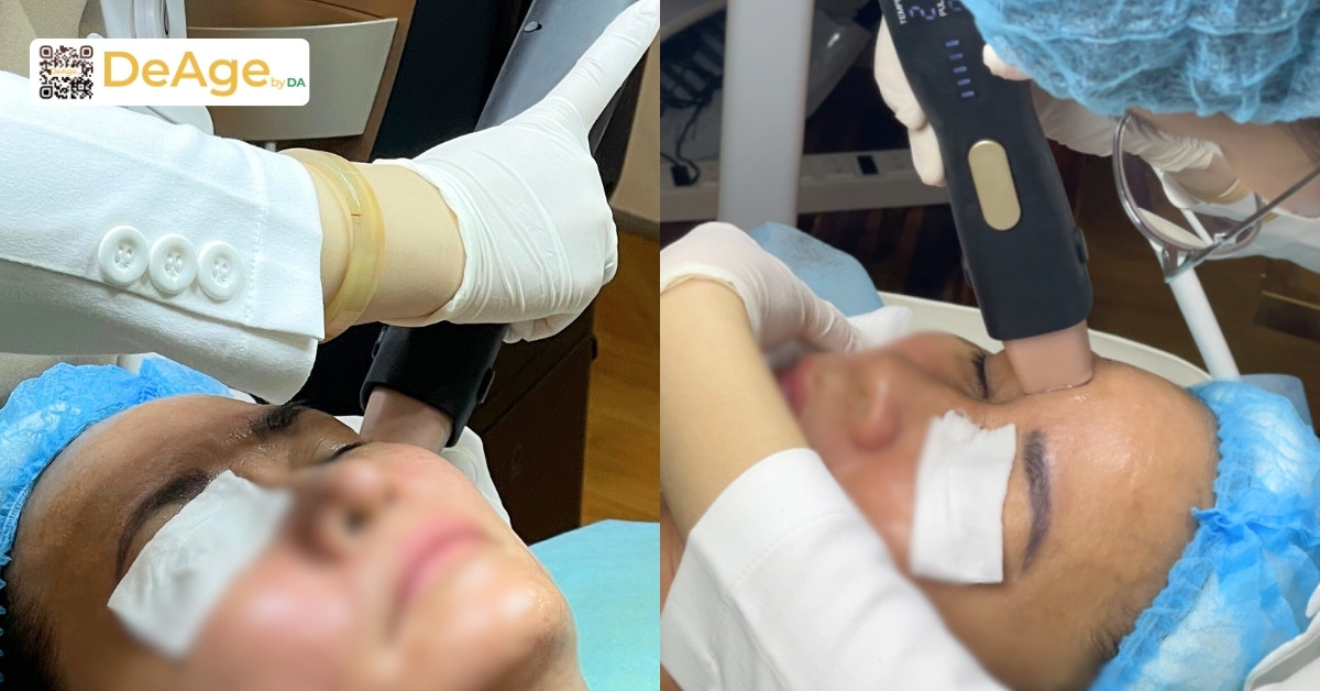 Top 10 phương pháp trẻ hóa vùng mắt hiệu quả hiện nay 7 density vùng mắt