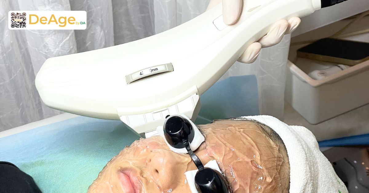 Nếp nhăn tĩnh: dấu hiệu nhận biết, nguyên nhân và giải pháp cải thiện 13 ipl