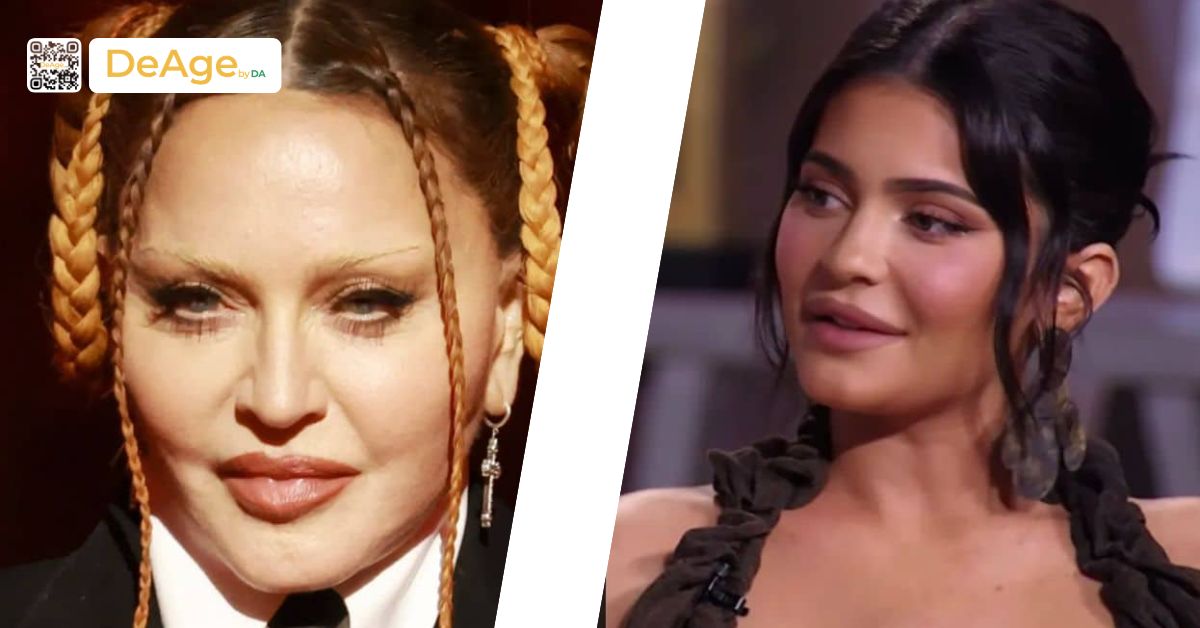 Hiện tượng over filler là gì? Nguyên nhân và cách phòng tránh 4 over filler