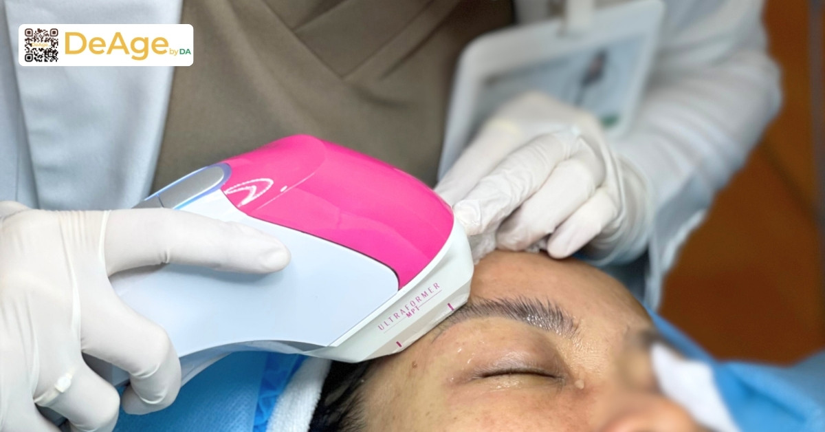 Top 10 phương pháp trẻ hóa vùng mắt hiệu quả hiện nay 8 pp hifu vùng mắt