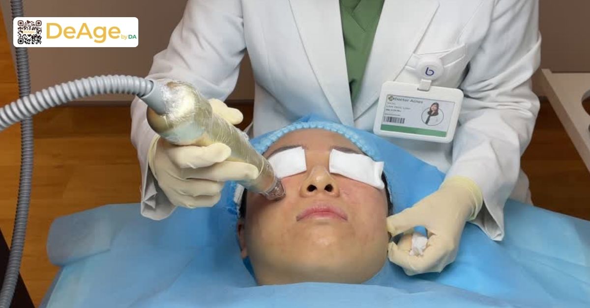 Nếp nhăn tĩnh: dấu hiệu nhận biết, nguyên nhân và giải pháp cải thiện 11 bsi thực hiện pp sylfirm x