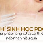 Chỉ sinh học PDO: giải pháp nâng cơ và cải thiện nếp nhăn hiệu quả