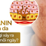 Melanin và nám da: chuyện gì xảy ra dưới da mỗi ngày?