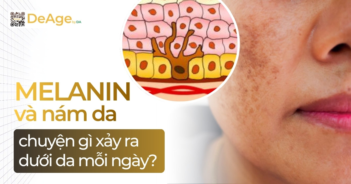 thumb melanin và nám da