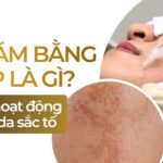 Giải đáp: trị nám bằng PRP có thực sự hiệu quả như lời đồn?