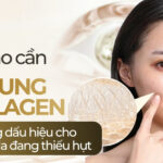 Khi nào cần bổ sung collagen và những dấu hiệu cho thấy làn da đang thiếu hụt