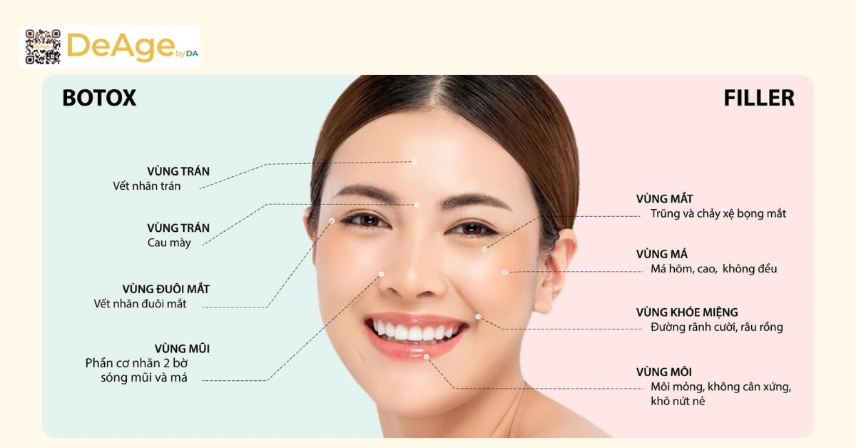 Nên tiêm filler hay botox, phương pháp nào tốt hơn? 7 Tối ưu hiệu quả trẻ hóa