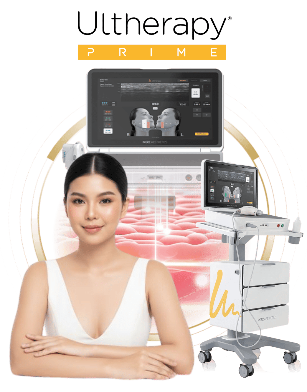 Ultherapy prime
