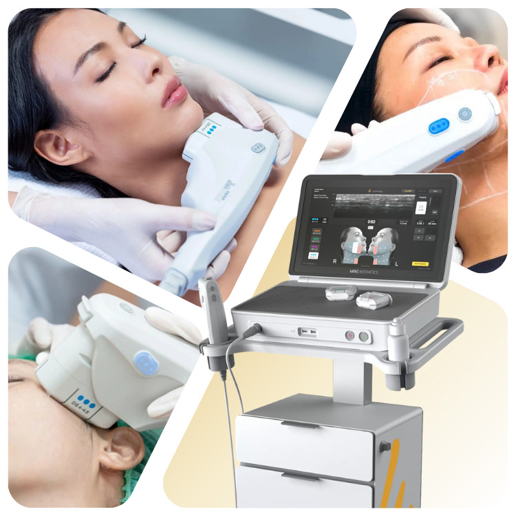 Ultherapy prime