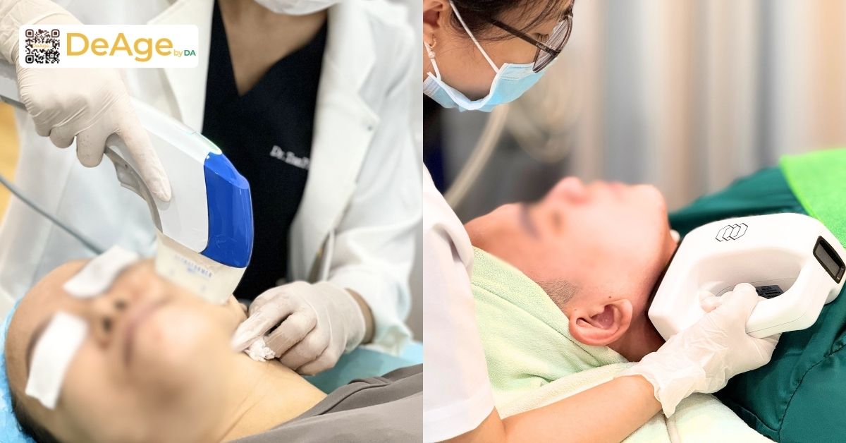 HIFU và InMode Lift trong nâng cơ và giảm mỡ mặt, nên chọn phương pháp nào? 1 bác sĩ đang thực hiện pp HIFU bên trái và InMode Life bên phải