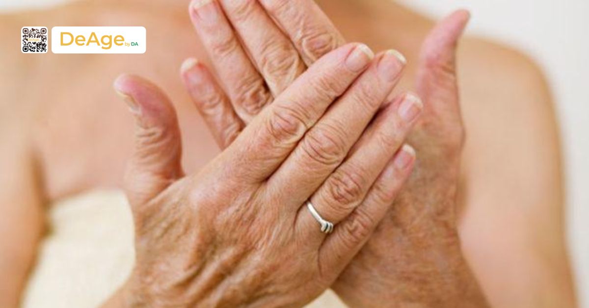 Top các phương pháp trẻ hóa bàn tay hiệu quả hiện nay 1 da tay bị nhăn nheo, lão hóa có thể do nhiều nguyên nhân khác nhau