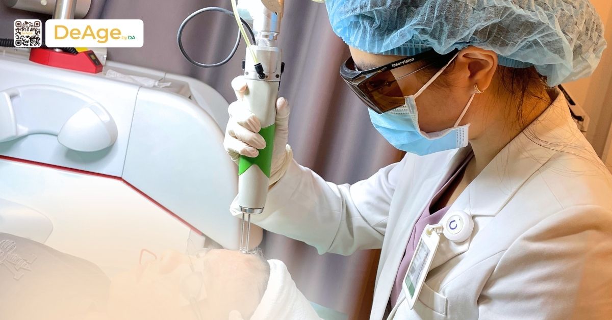 Laser pico là gì và các ứng dụng trong trẻ hóa da 3 bs thực hiện laser pico
