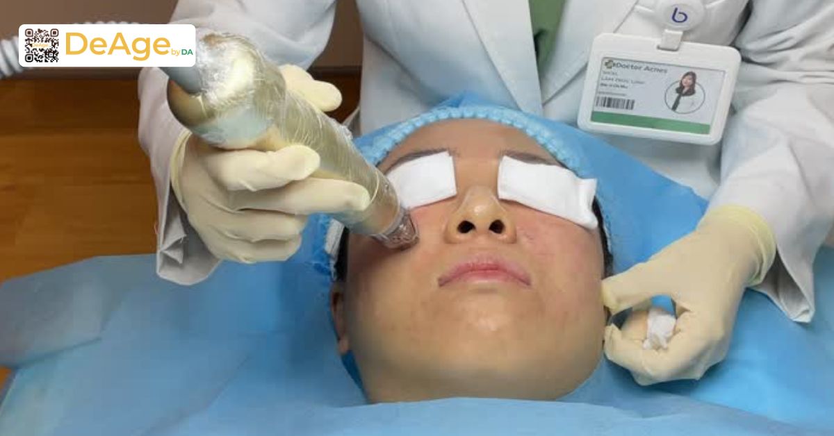 Nguyên nhân da sần sùi và cách cải thiện để làn da mịn màng hơn 10 công nghệ Sylfirm X vùng mắt tại Deage by DA