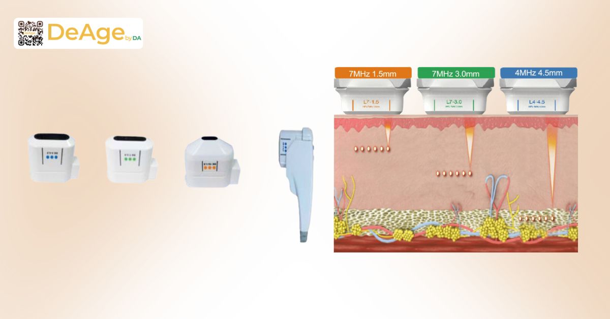 Công nghệ nâng cơ Ultherapy giá bao nhiêu? Chi phí có xứng đáng với hiệu quả? 4 đầu tip Ultherapy với độ sâu khác nhau giúp cá nhân hóa điều trị
