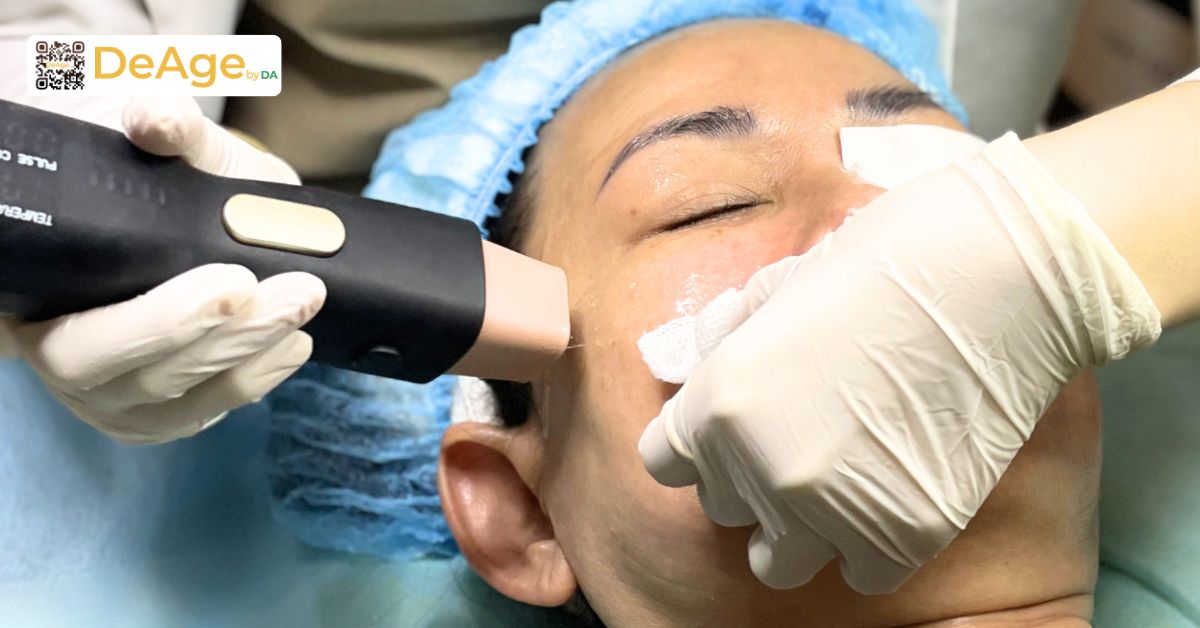 Nếp nhăn động là gì và làm cách nào để cải thiện hiệu quả? 12 density