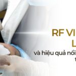 RF vi điểm là gì và hiệu quả nổi bật trong trẻ hóa da