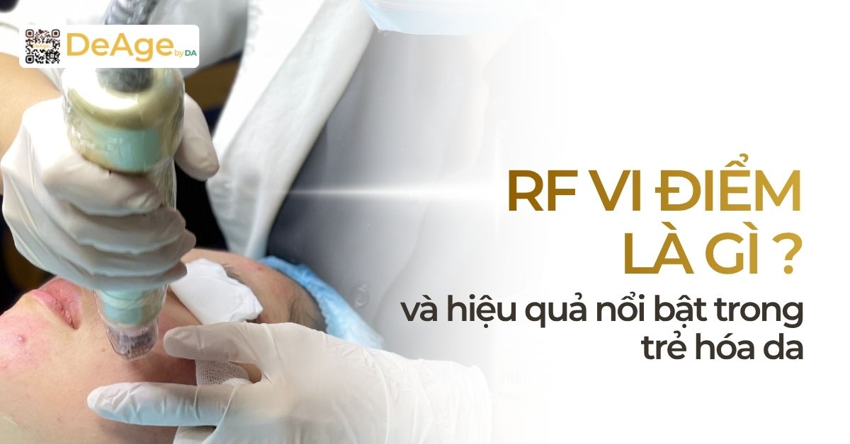 thumb RF vi điểm là gì và hiệu quả nổi bật trong trẻ hóa da