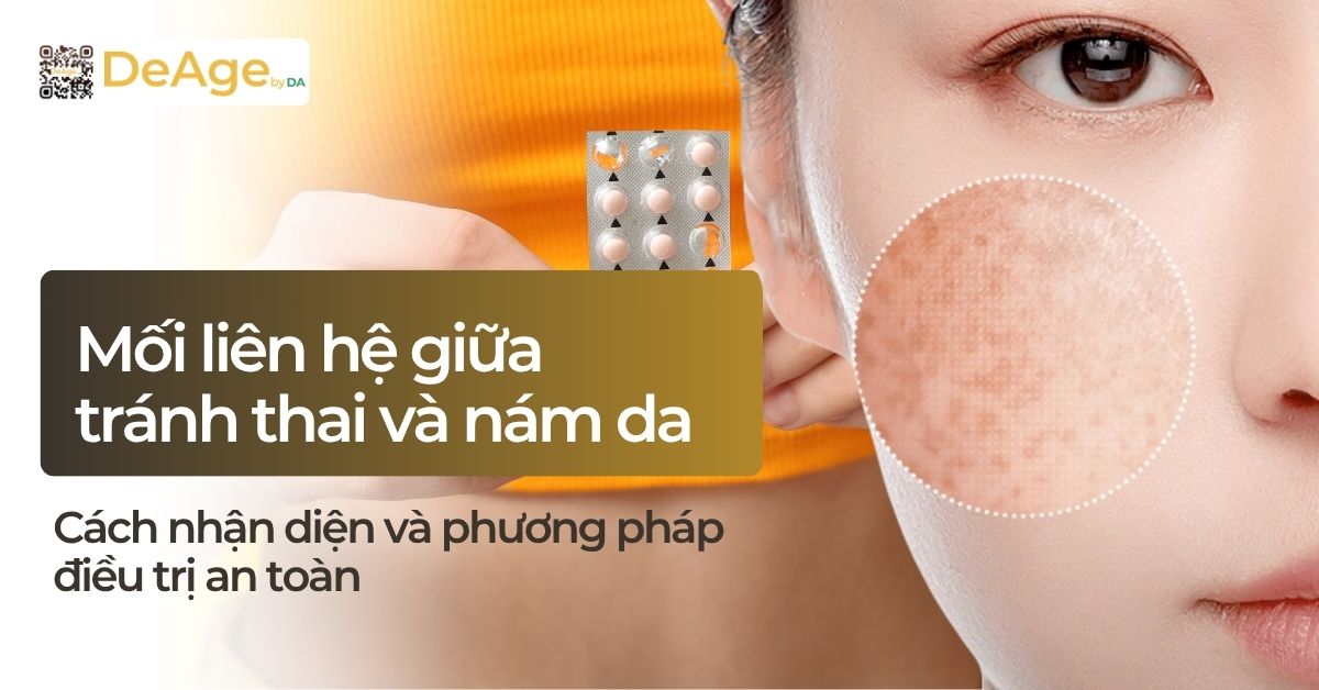thumb các mối liên hệ giữa tránh thai và nám da