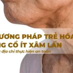 Các phương pháp trẻ hóa vùng cổ ít xâm lấn và địa chỉ thực hiện an toàn