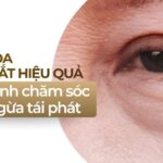 Cách xóa bọng mắt hiệu quả và lộ trình chăm sóc ngăn ngừa tái phát