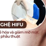 Công nghệ HIFU – Nâng cơ trẻ hóa và giảm mỡ mặt không cần phẫu thuật