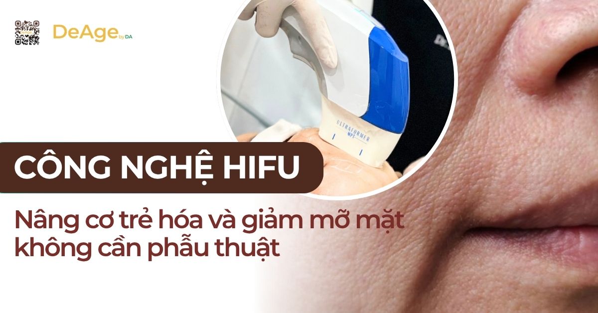 thumb công nghệ hifu