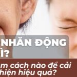 Nếp nhăn động là gì và làm cách nào để cải thiện hiệu quả?