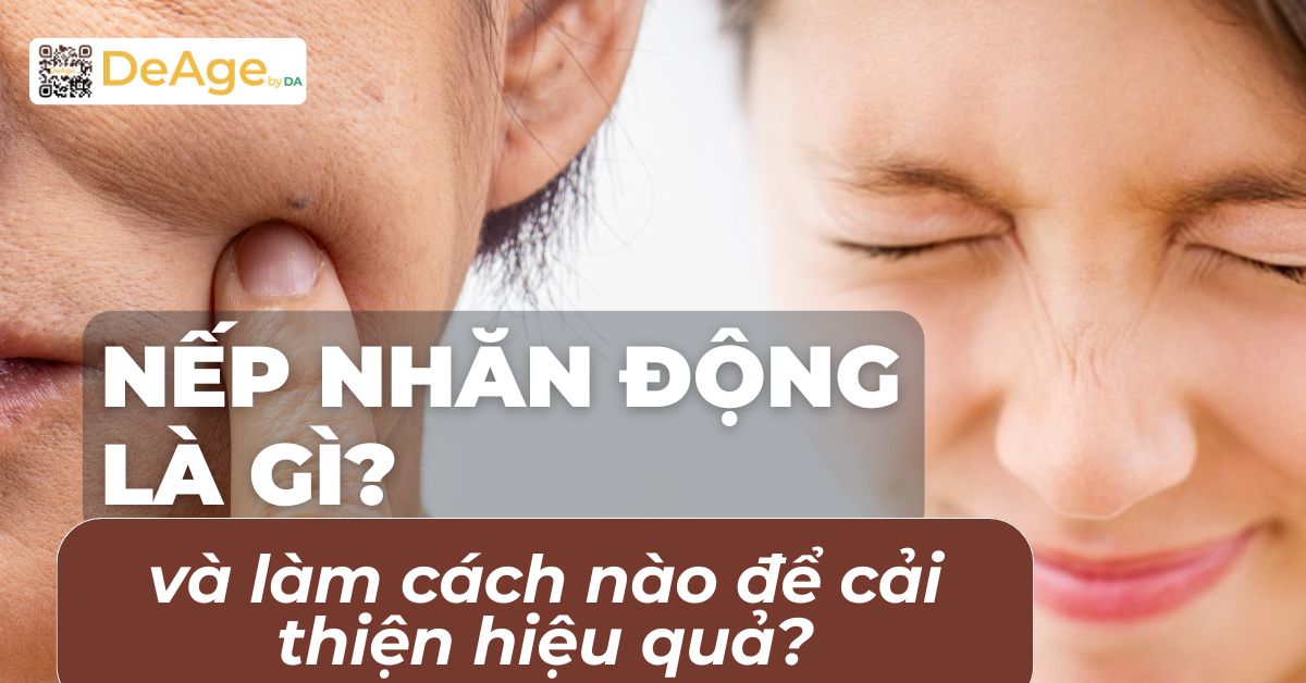 thumb nếp nhăn động