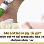 Mesotherapy là gì? Hiệu quả và đối tượng phù hợp với phương pháp này