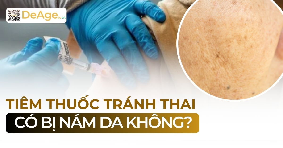 thumb tiêm thuốc tránh thai có bị nám da hay không