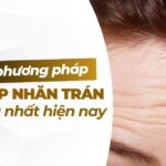 Top các phương pháp xóa nếp nhăn trán hiệu quả nhất hiện nay