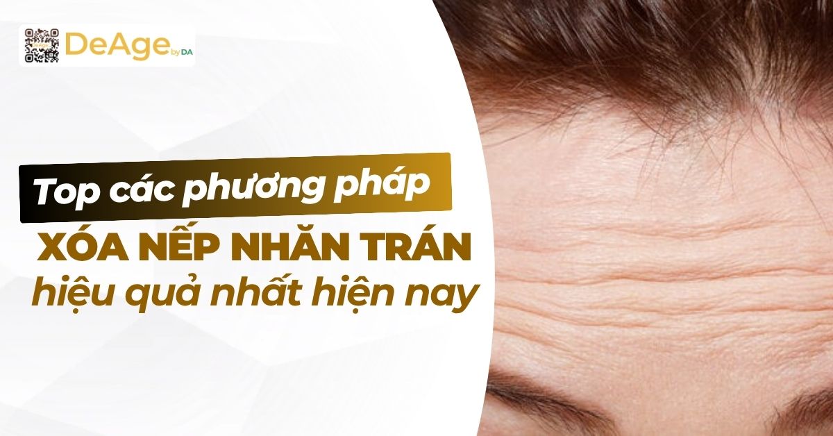 thumb xóa nếp nhăn vùng trán