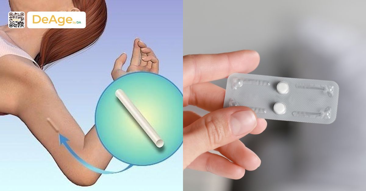 Mối liên hệ giữa tránh thai và nám da: cách nhận diện và phương pháp điều trị an toàn 4 tránh thai hóa học