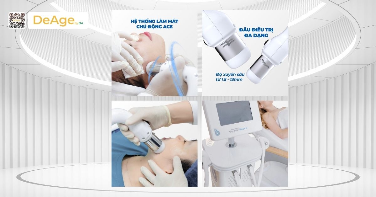 Công nghệ CFU là gì? Nguyên lý hoạt động, hiệu quả và đối tượng phù hợp 4 ưu điểm nổi bật của CFU Èlife