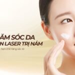 Cách chăm sóc da sau khi bắn laser trị nám giúp phục hồi nhanh và hạn chế tăng sắc tố