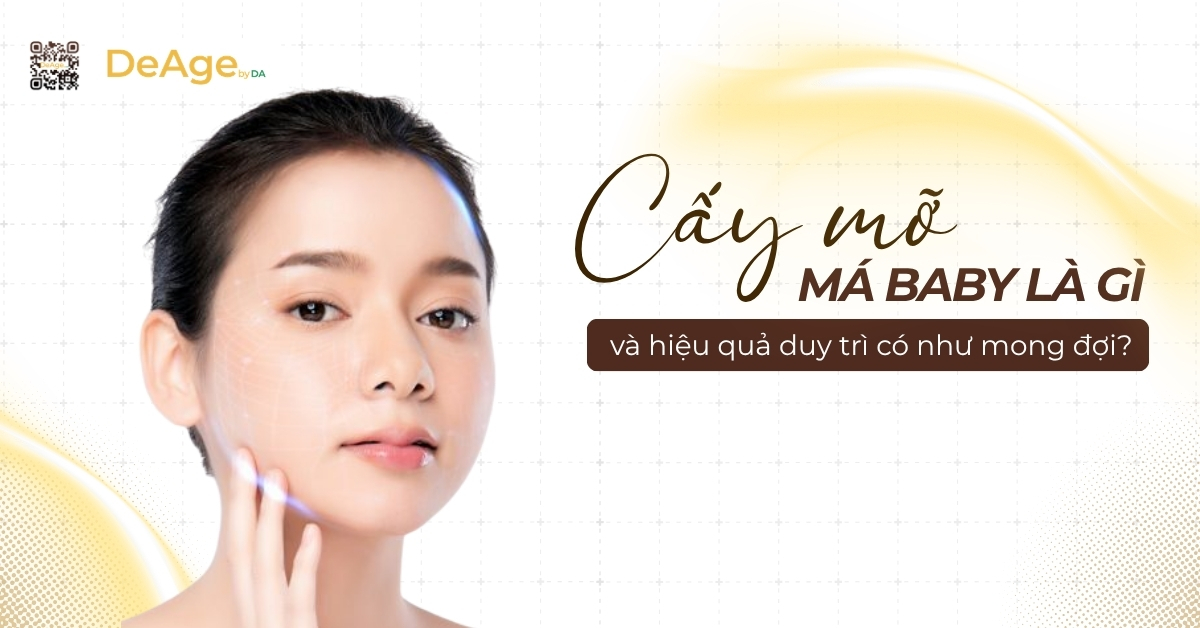 Thumb Cấy mỡ má baby là gì và hiệu quả duy trì có như mong đợi?