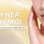 Giảm nếp nhăn môi bằng cách nào hiệu quả và duy trì được bao lâu?