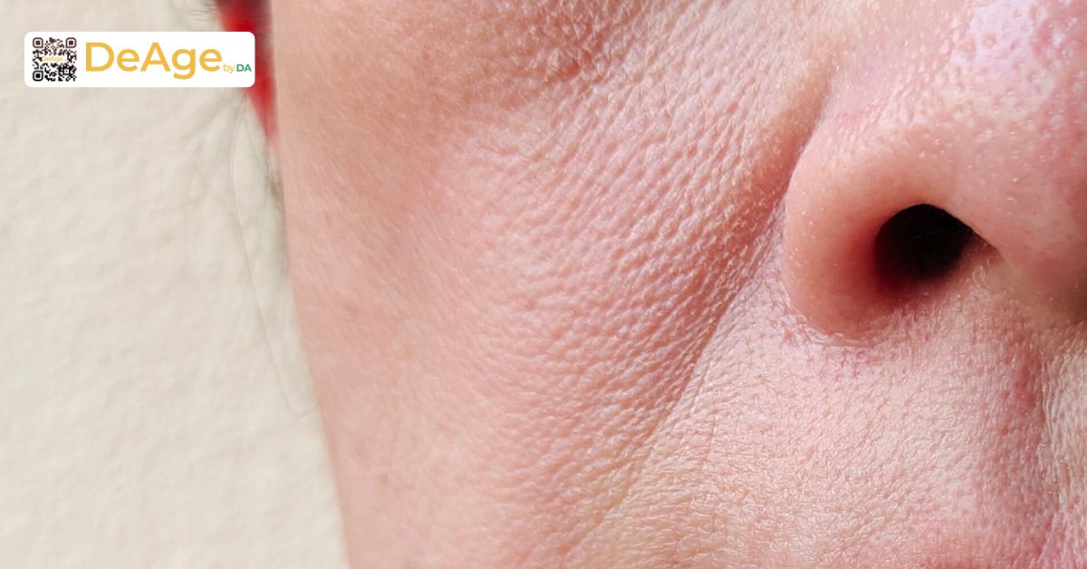 Tại sao phải bổ sung collagen và những yếu tố khiến collagen suy giảm nhanh 2 chảy xệ