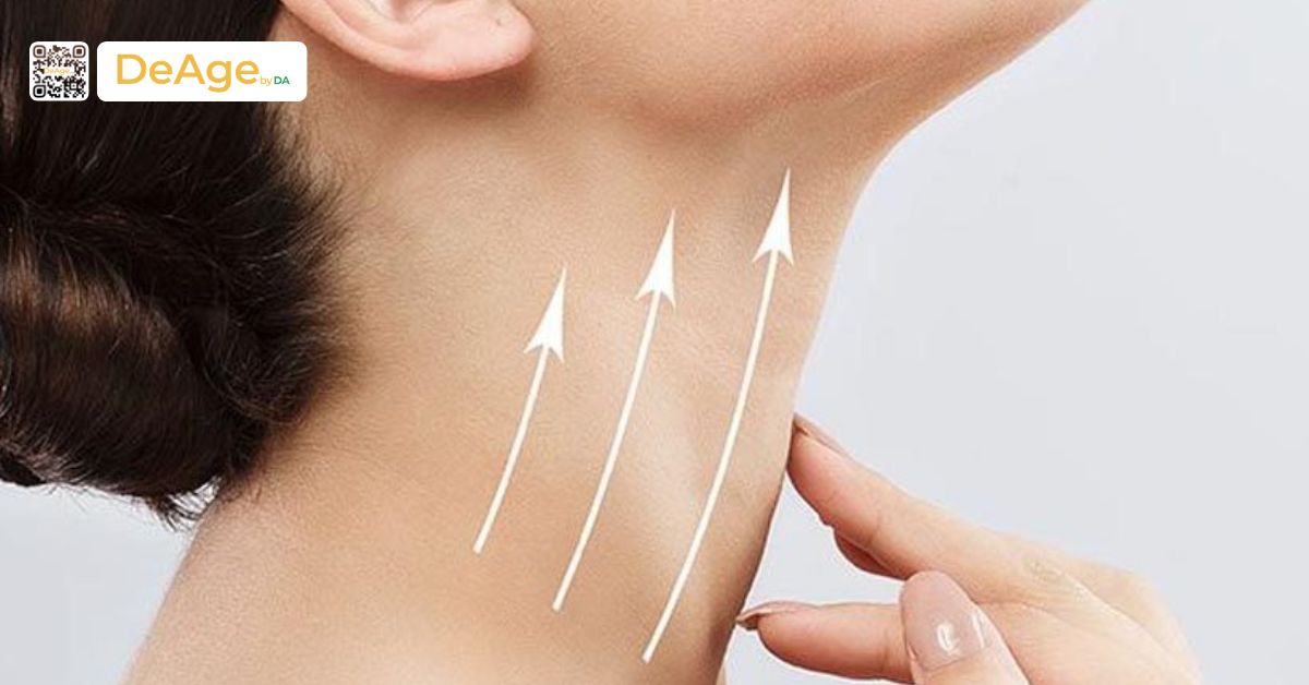Nguyên nhân hình thành và các phương pháp xóa nếp nhăn cổ an toàn hiện nay 9 Căng chỉ
