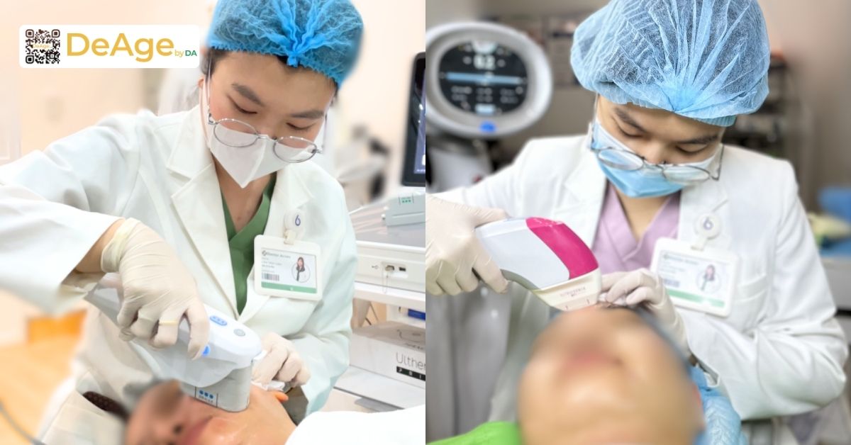 Mặt V-line là gì? Cách tạo gương mặt V-line thon gọn an toàn và hiệu quả 17 Công nghệ HIFU