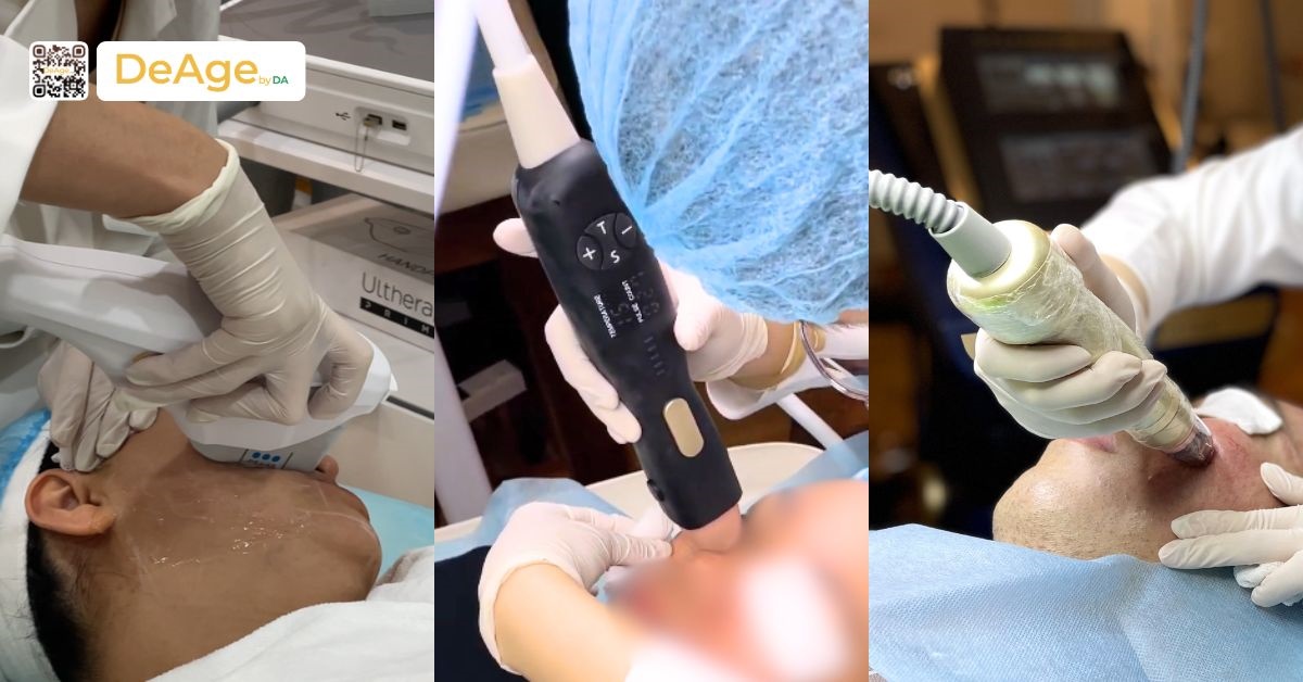 Top 6 cách xóa nhăn rãnh cười giúp gương mặt trẻ trung hơn 8 Công nghệ cao