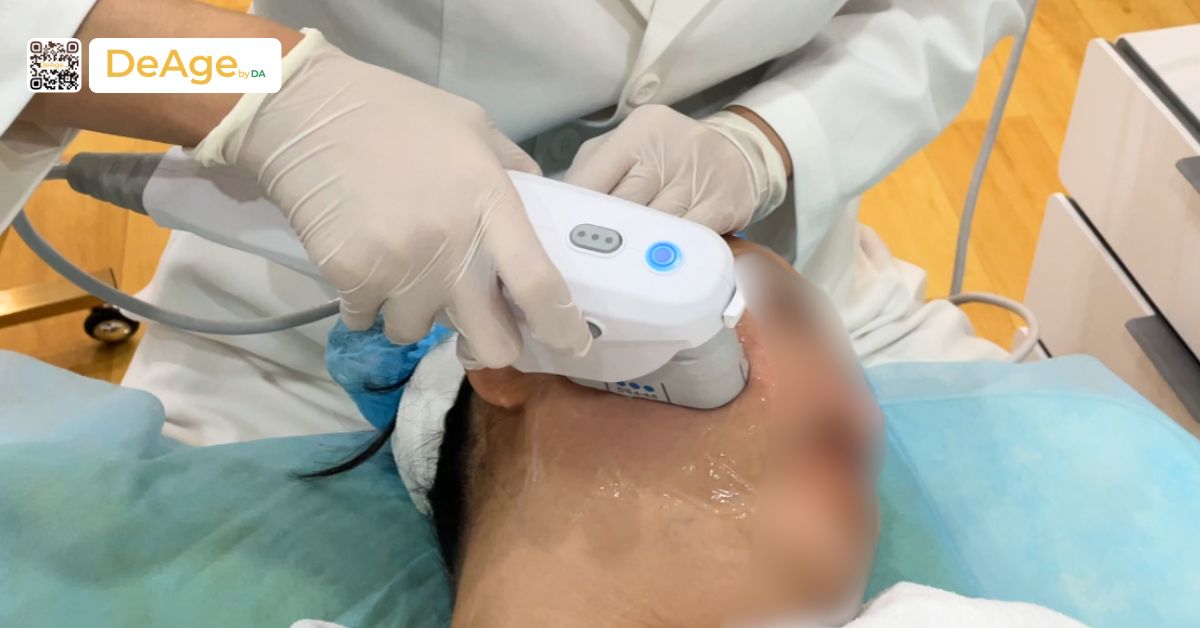 Căng da mặt không phẫu thuật: giải pháp trẻ hóa da an toàn, không cần nghỉ dưỡng 3 Khách hàng trải nghiệm Ultherapy Prime tại Deage by DA