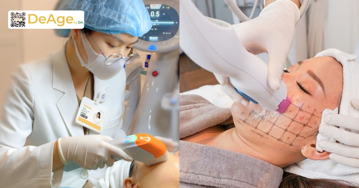 So sánh HIFU và Thermage trong nâng cơ trẻ hóa da 5 HIFU và Thermage