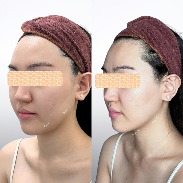 Hiệu quả nâng cơ tự nhiên
