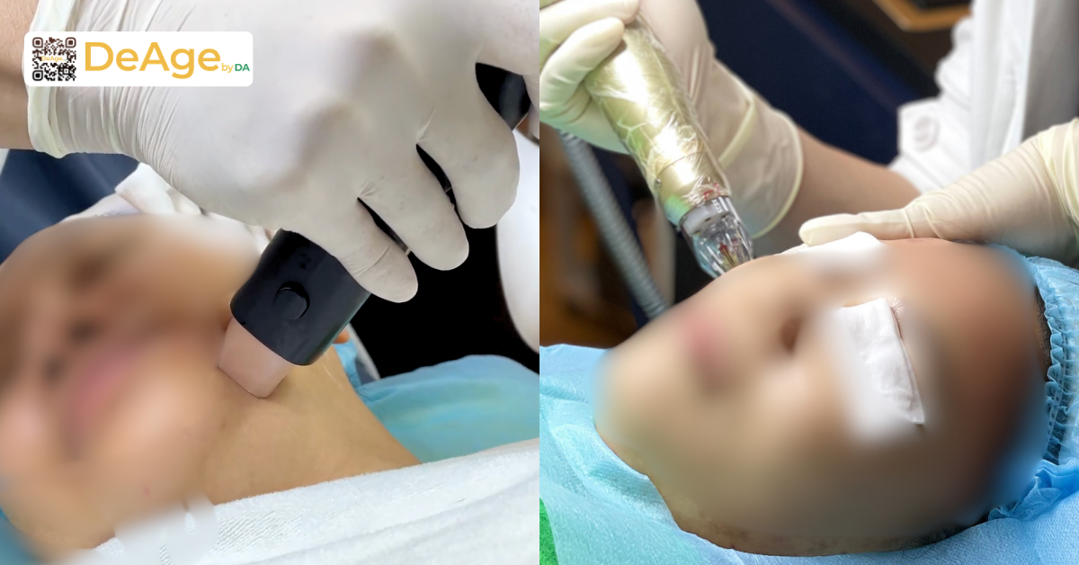 Hướng dẫn massage căng da mặt giúp da săn chắc và tươi tắn hơn 8 BS làm Density và Sylfirm X