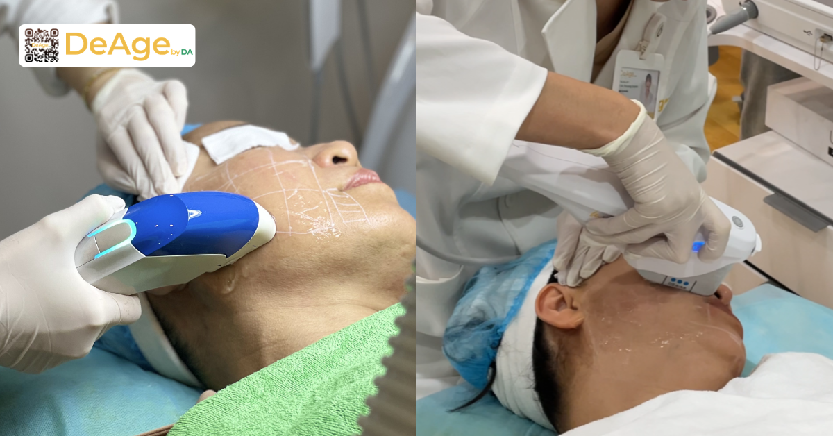 Hướng dẫn massage căng da mặt giúp da săn chắc và tươi tắn hơn 6 Hình bs làm MPT và Prime