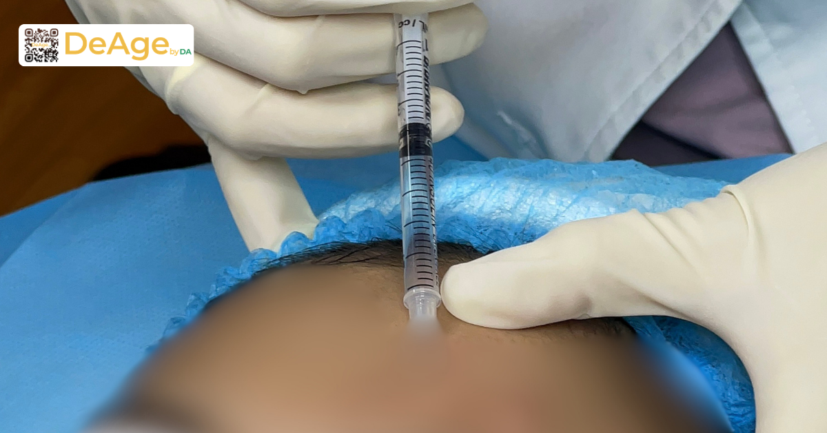 Hướng dẫn massage căng da mặt giúp da săn chắc và tươi tắn hơn 9 Hình bs tiêm Botox trán