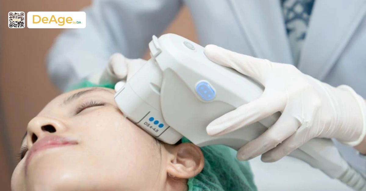 Công nghệ nâng cơ Ultherapy giá bao nhiêu? Chi phí có xứng đáng với hiệu quả? 3 Liệu trình Ultherapy có đáng với mức giá không
