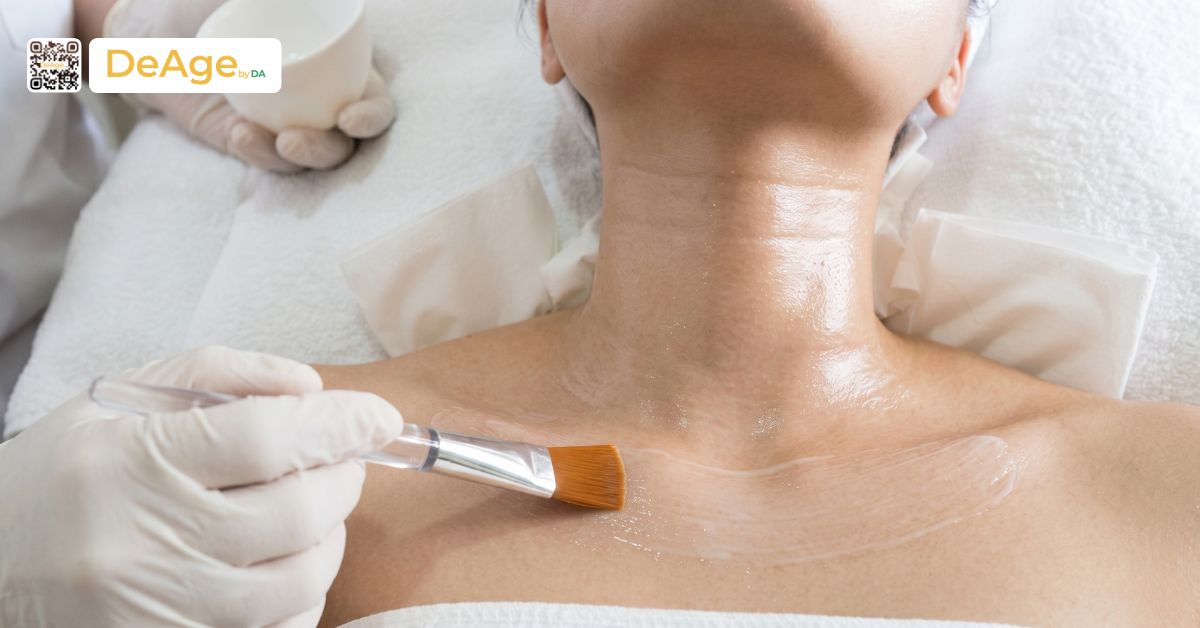 Nguyên nhân hình thành và các phương pháp xóa nếp nhăn cổ an toàn hiện nay 8 Peel da hóa học