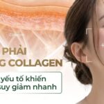 Tại sao phải bổ sung collagen và những yếu tố khiến collagen suy giảm nhanh